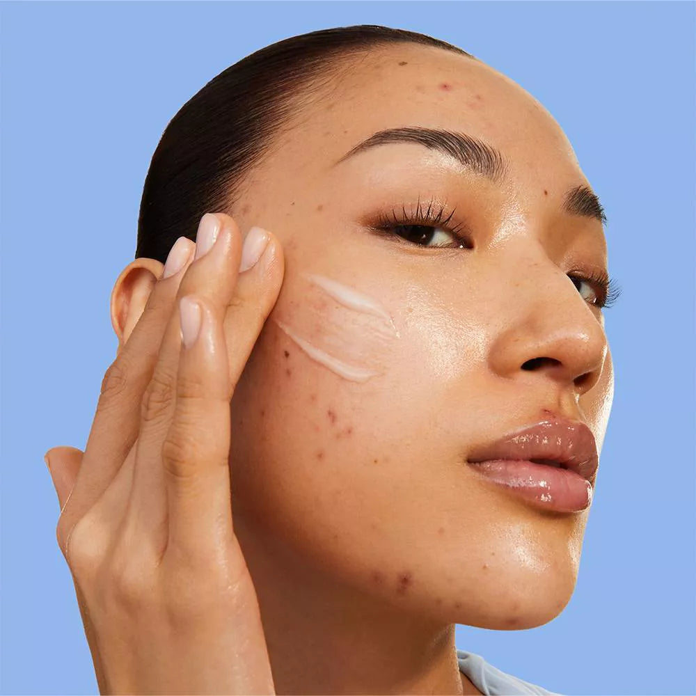 Blemish Acne Control Moisturizer