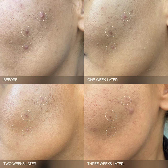 Mini Faded Serum for Dark Spots & Discoloration