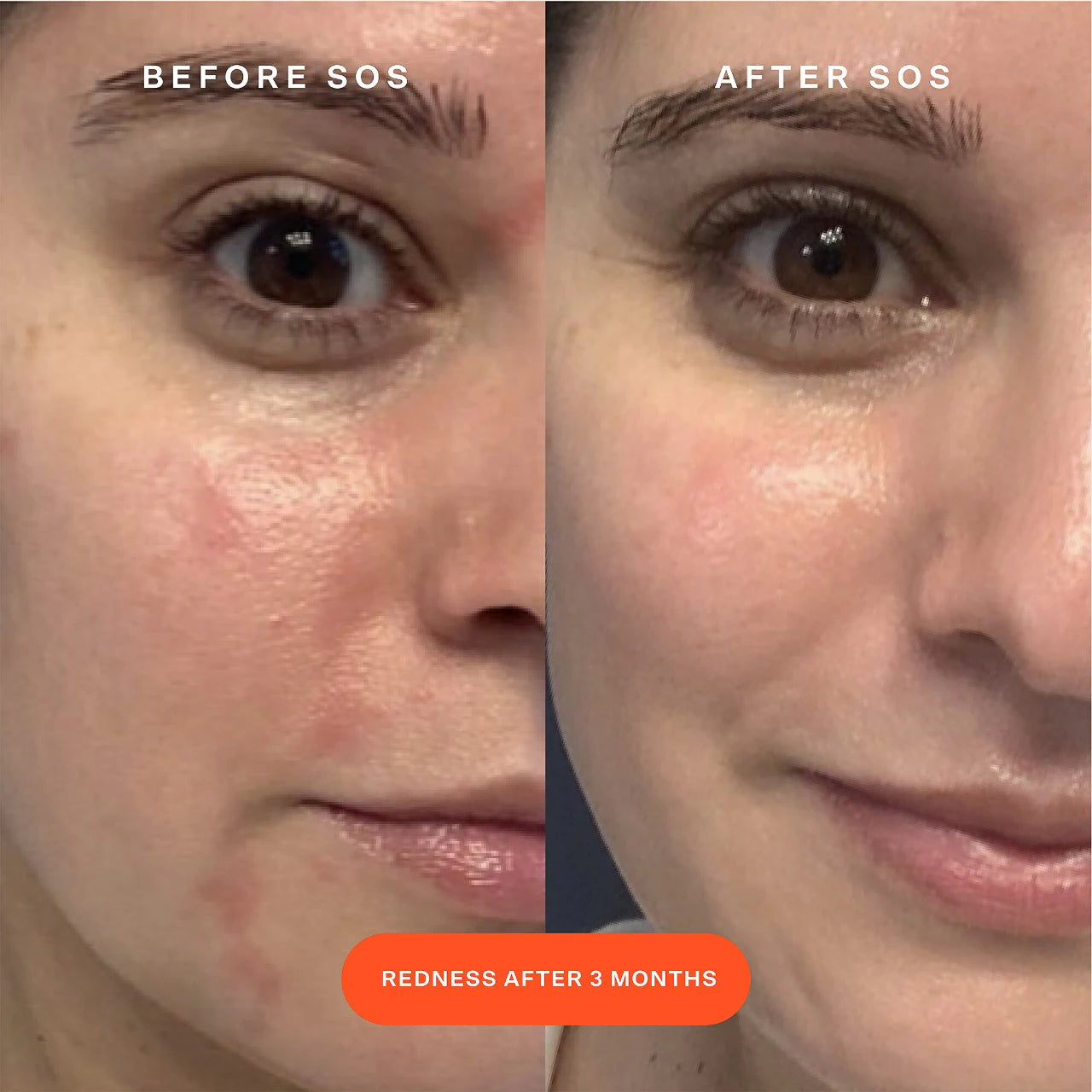 SOS Save.Our.Skin Facial Spray