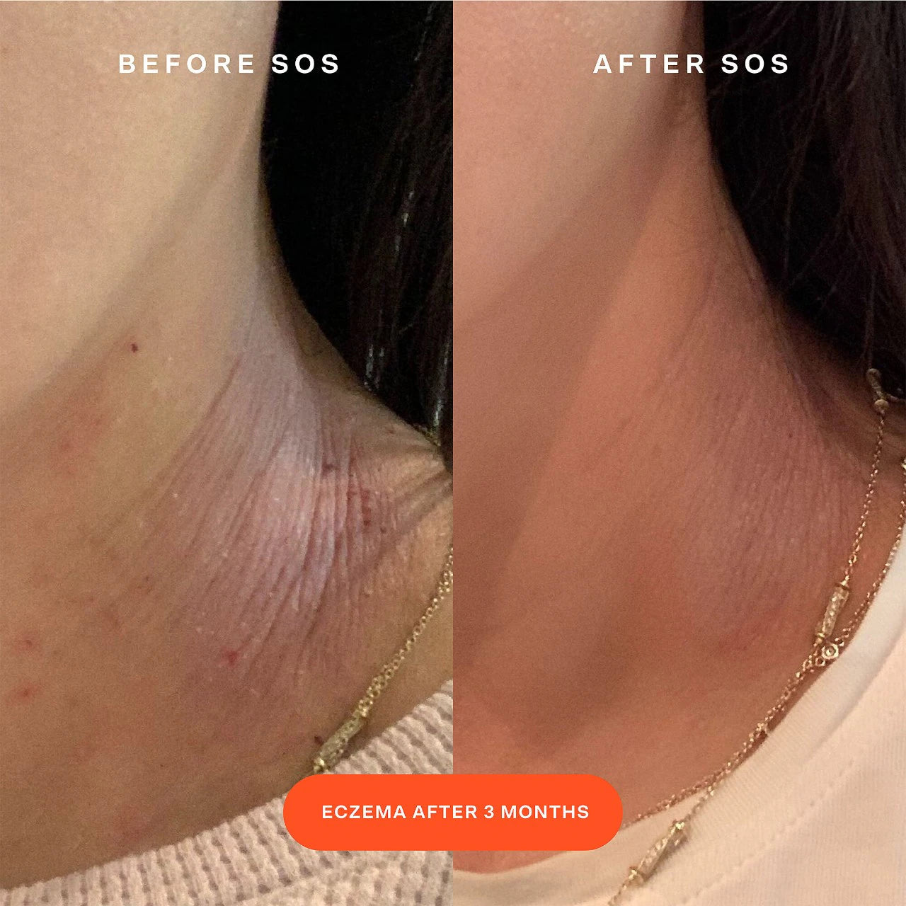 SOS Save.Our.Skin Facial Spray