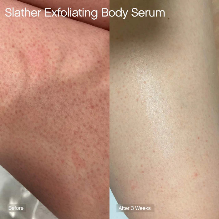 Slather Exfoliating Body Serum