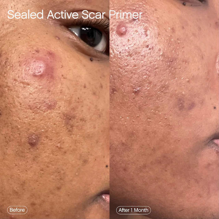 Sealed Active Scar Filling Primer