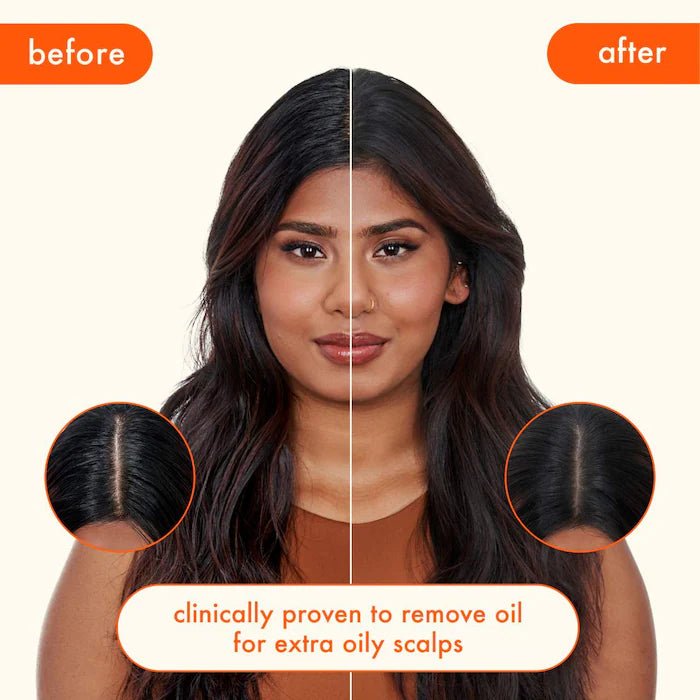 Perk Up Ultra Oil Control Dry Shampoo