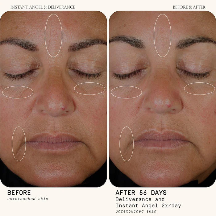Instant Angel Barrier Repair
