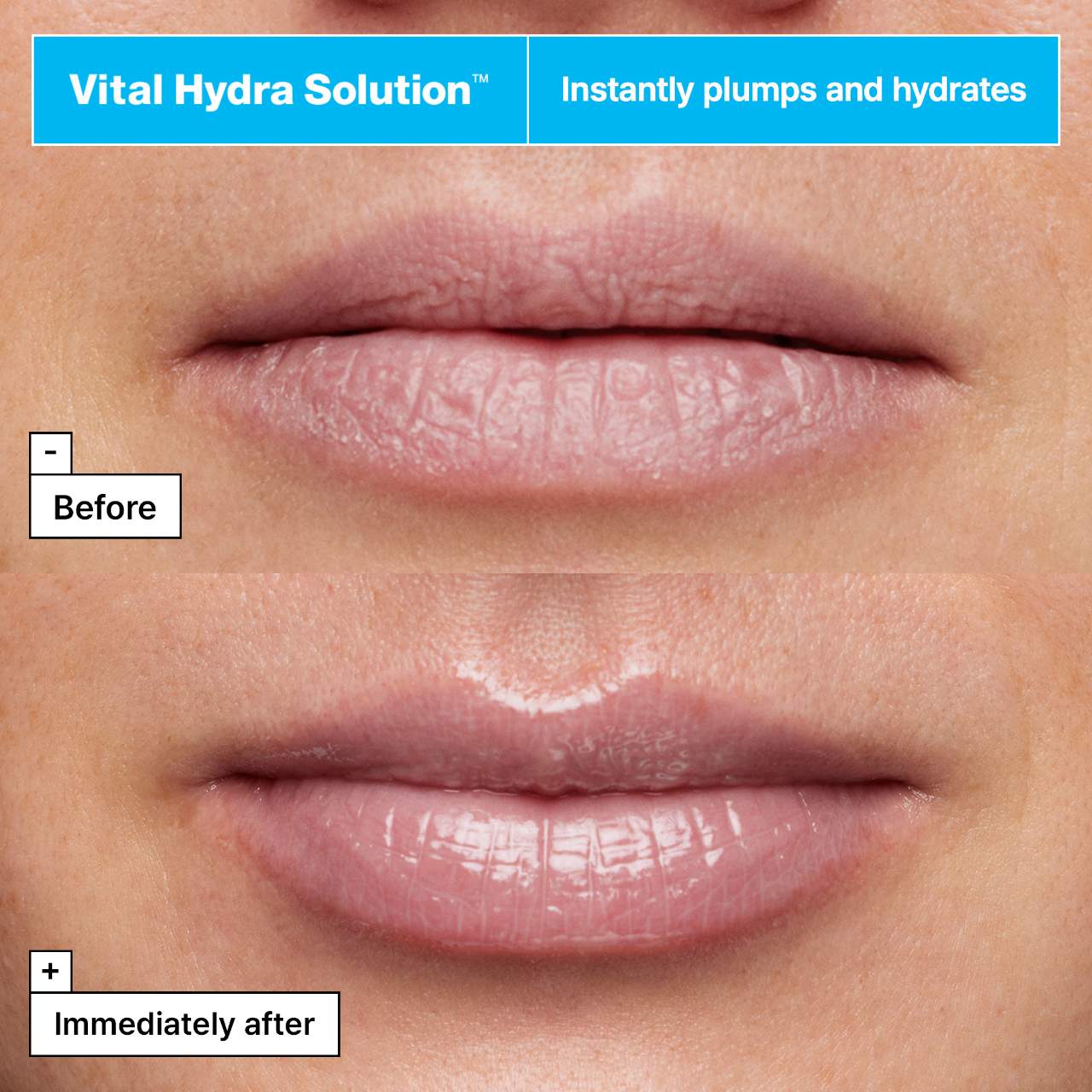 Vital Hydra Solution™ Jelly Bear Lip Mask