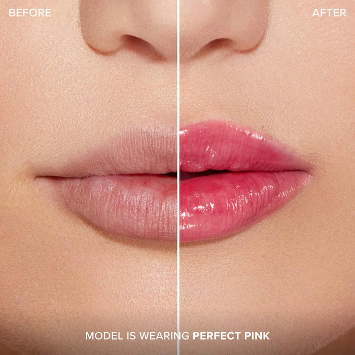 Lip Injection Extreme