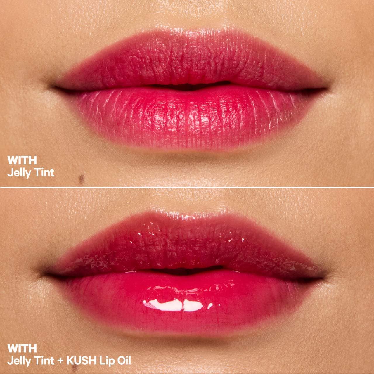 The Jelly Lip Kit