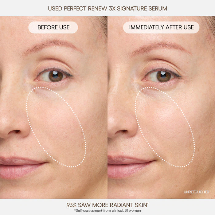 Perfect Renew 3x Signature Serum Advanced