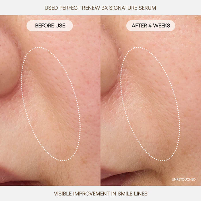 Perfect Renew 3x Signature Serum Advanced