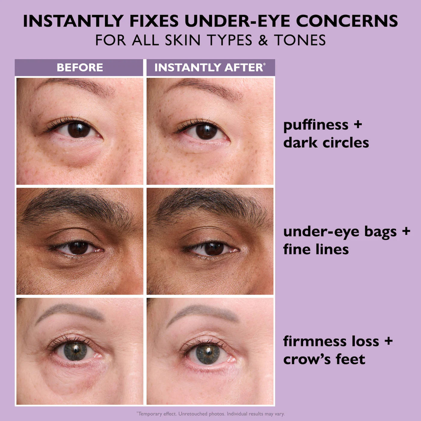 Instant FIRMx® Eye Temporary Tightener Easy-Wear Formula