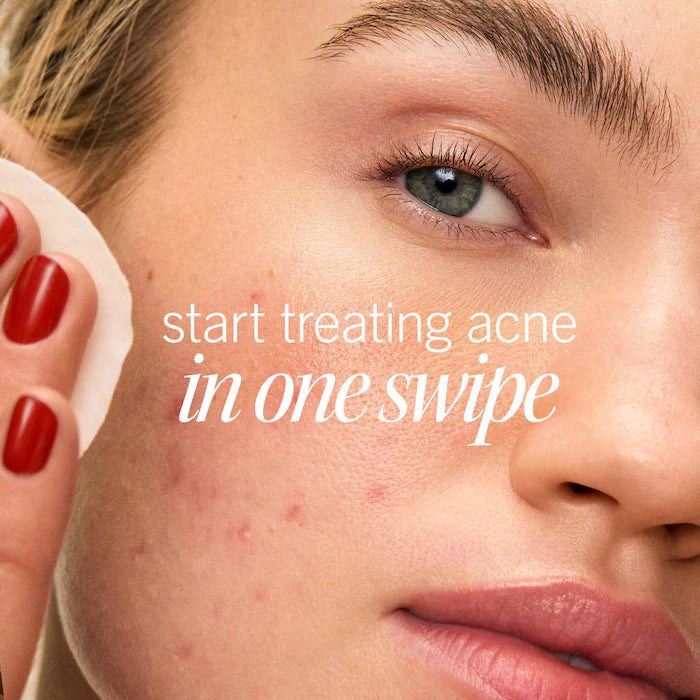 Acne Clearing Pads