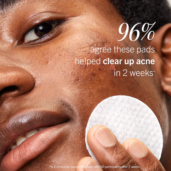 Acne Clearing Pads