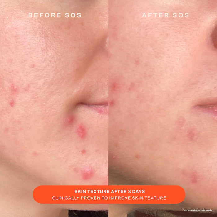 Mini SOS Daily Barrier Recovery Cream