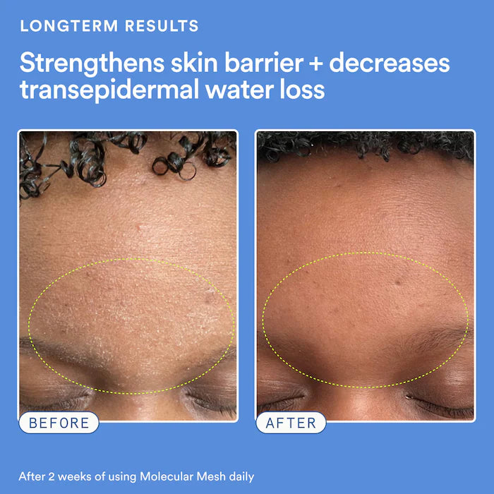 Molecular Mesh Moisturizer
