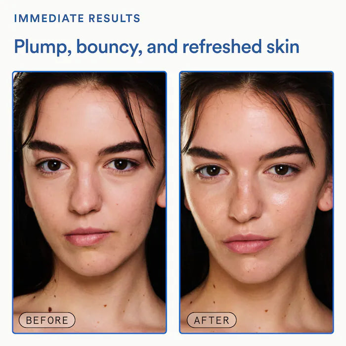 Molecular Mesh Moisturizer