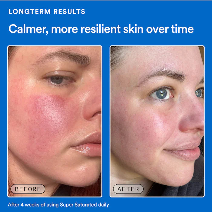 Super Saturated Serum