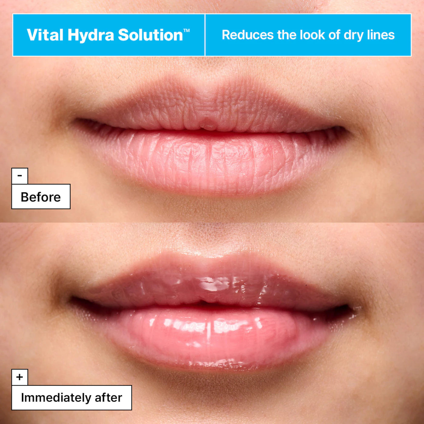 Vital Hydra Solution™ Jelly Bear Lip Mask