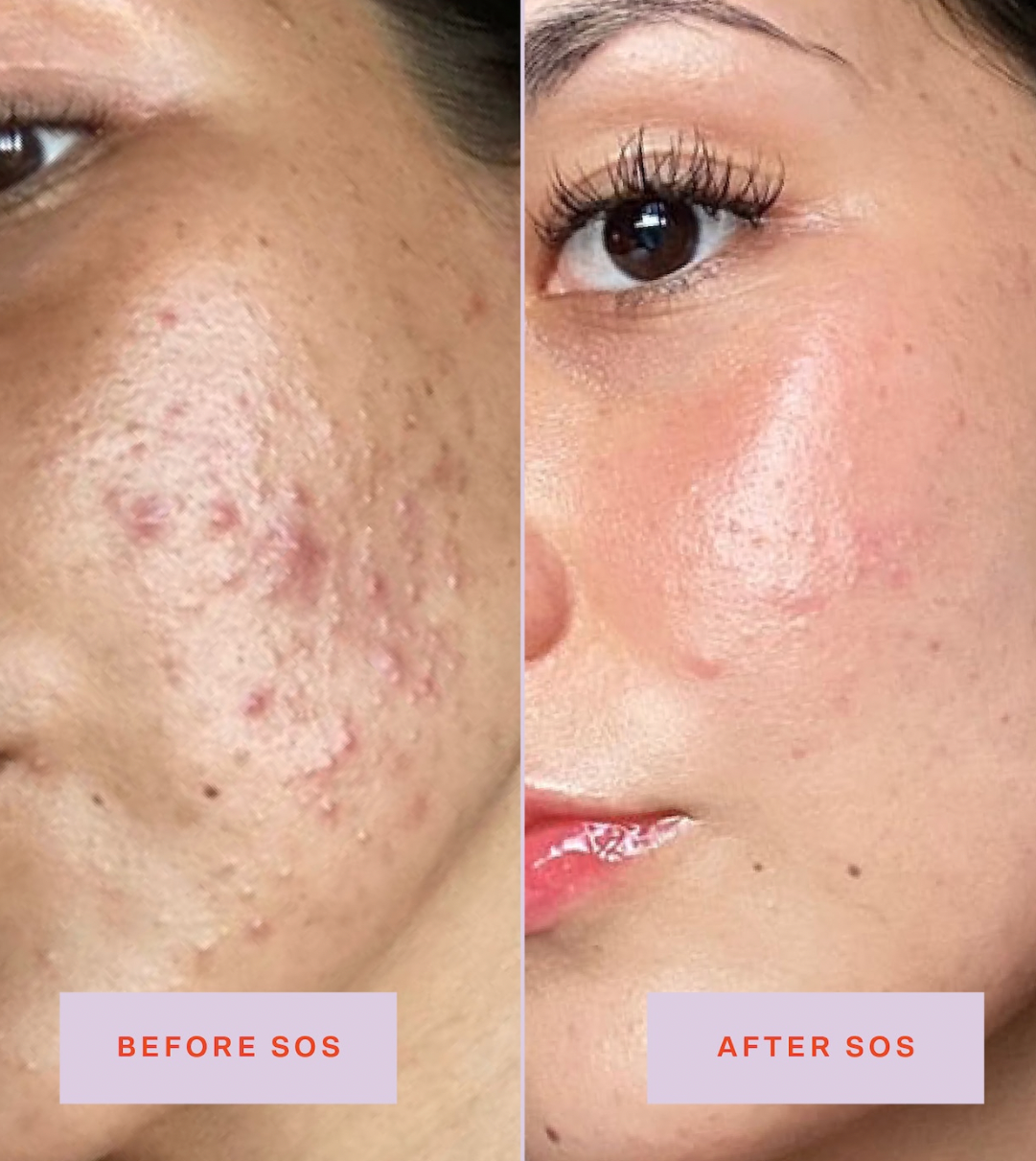 MINI SOS Save.Our.Skin Daily Rescue Facial Spray