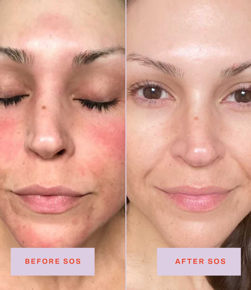 MINI SOS Save.Our.Skin Daily Rescue Facial Spray