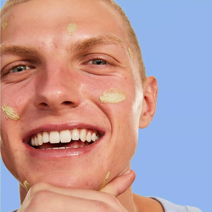 Blemish Acne Treatment Pimple Paste