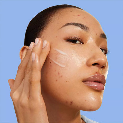 Blemish Acne Control Moisturizer