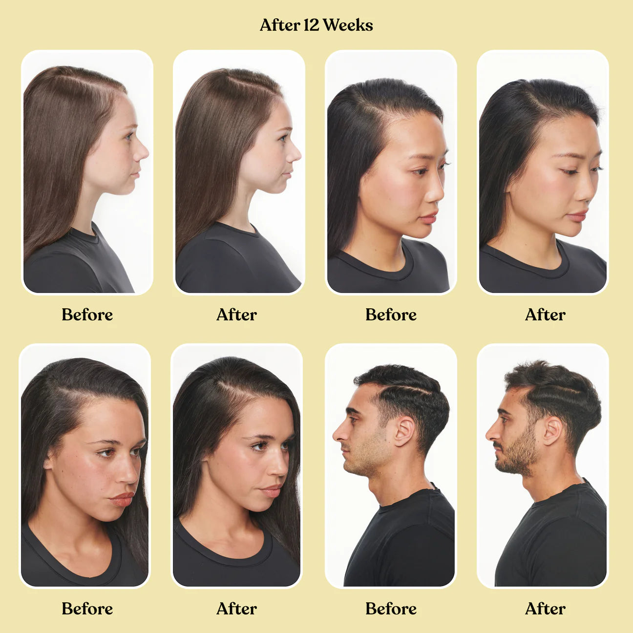 Lemme Grow Hair Growth & Anti-Shedding Capsules