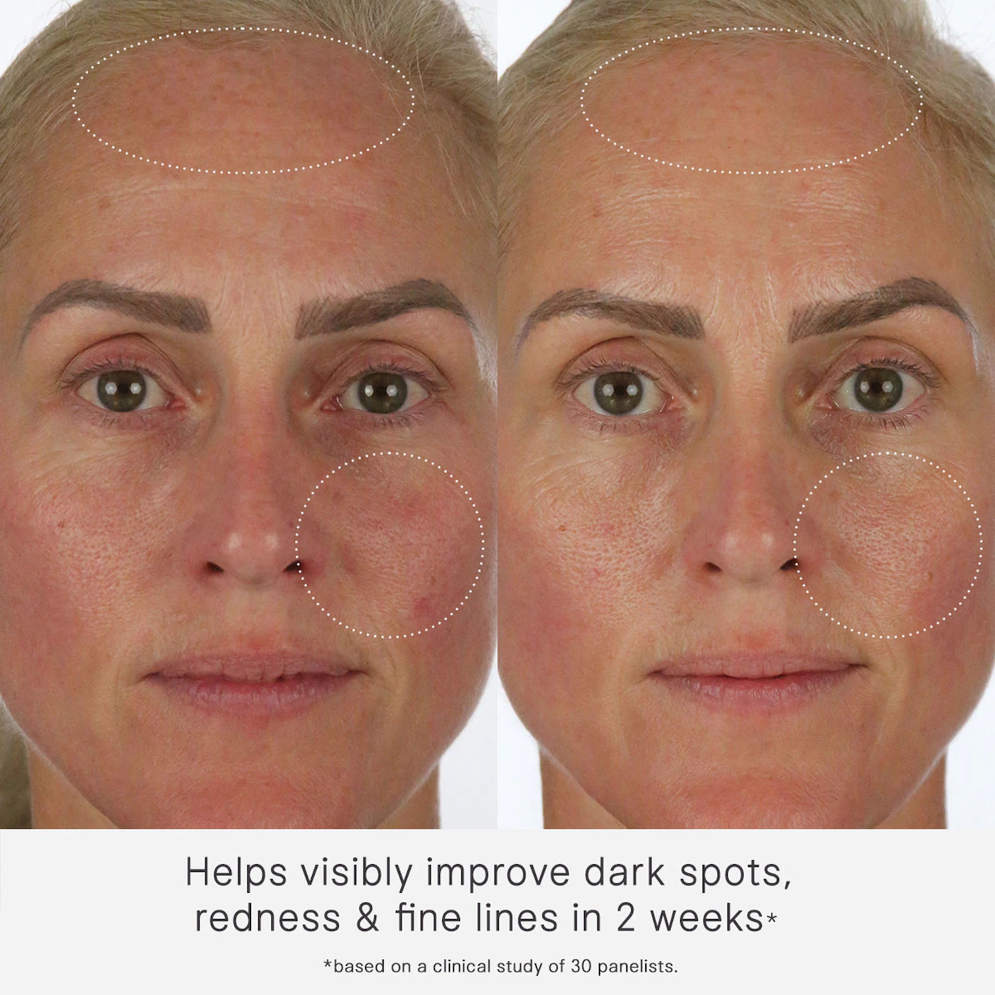The Milky Sunscreen