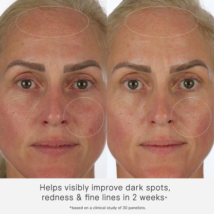 The Milky Sunscreen