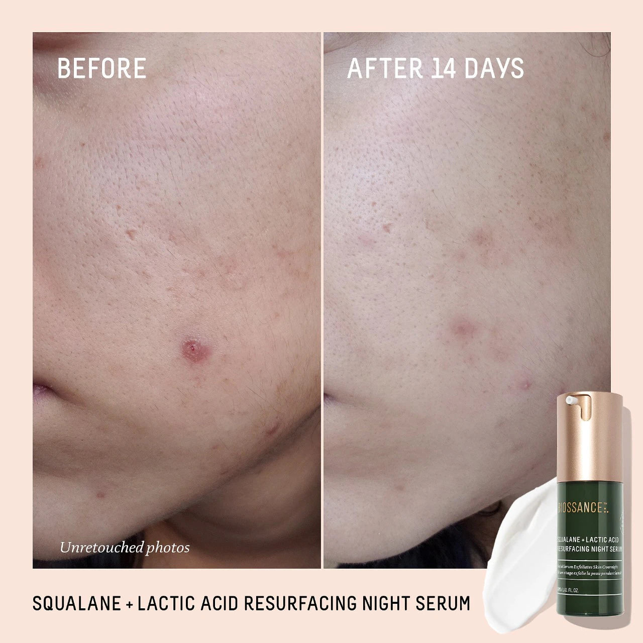 Squalane + 10% Lactic Acid Resurfacing Serum