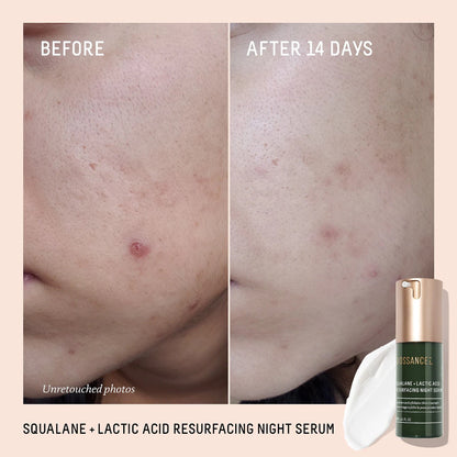 Squalane + 10% Lactic Acid Resurfacing Serum