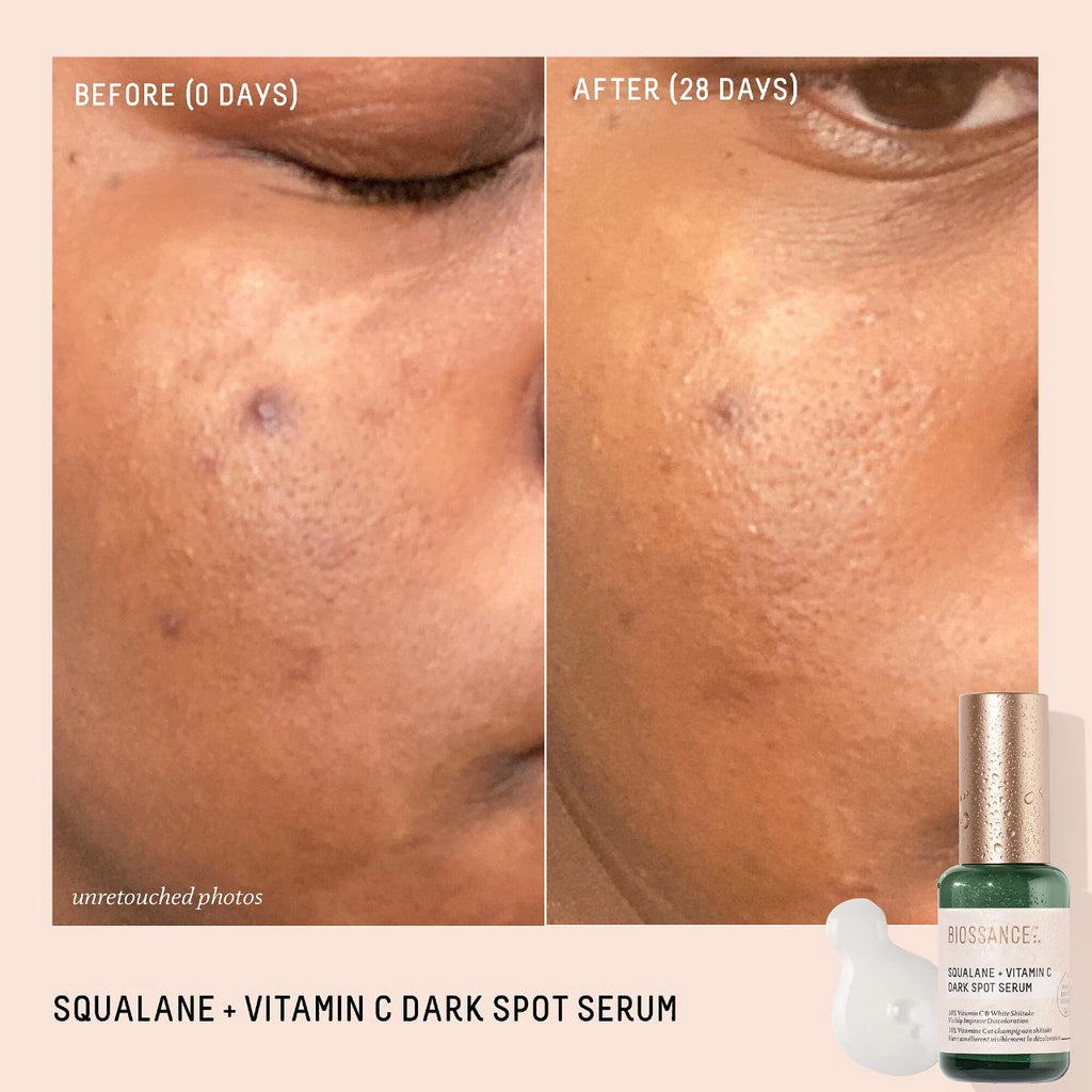 10% Vitamin C Dark Spot Serum + Squalane