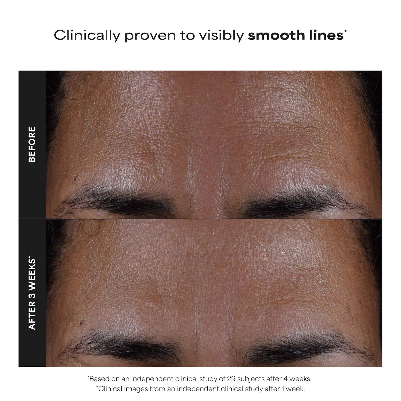 Skin Perfecting 2% BHA Exfoliating Toner for Clear Skin