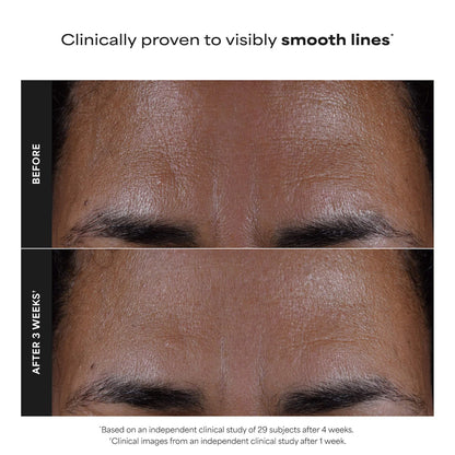 Skin Perfecting 2% BHA Exfoliating Toner for Clear Skin