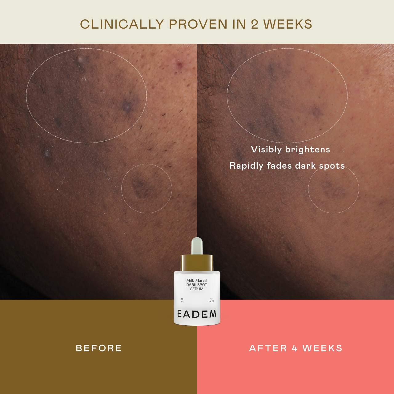 Milk Marvel Dark Spot Serum