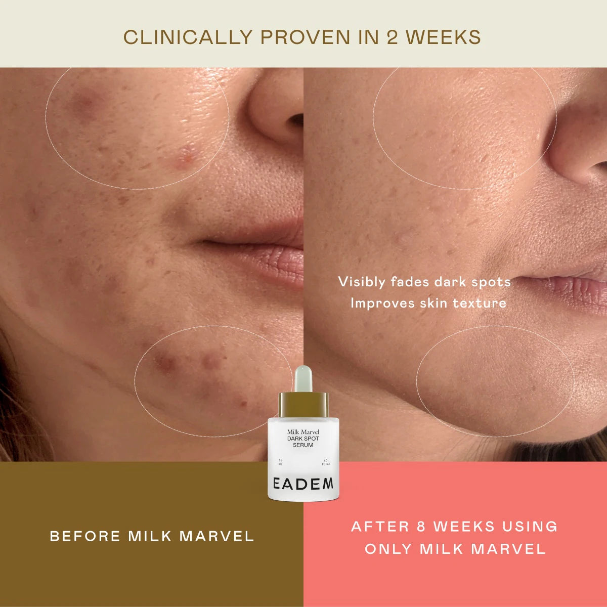 Milk Marvel Dark Spot Serum