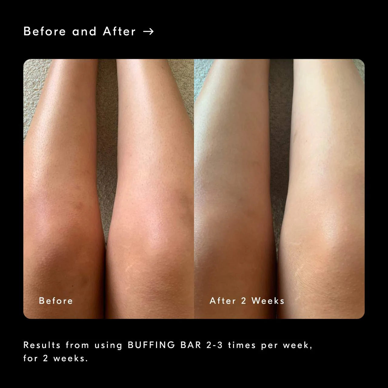Buffing Bar Exfoliating Body Bar for KP and Ingrown Hair