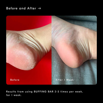 Buffing Bar Exfoliating Body Bar for KP and Ingrown Hair