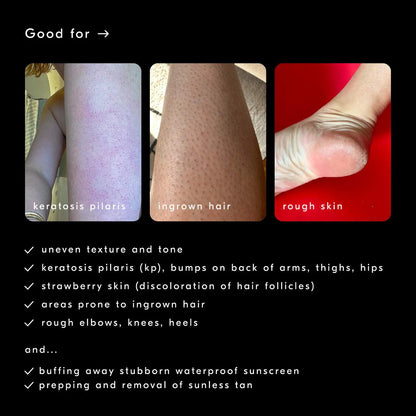 Buffing Bar Exfoliating Body Bar for KP and Ingrown Hair