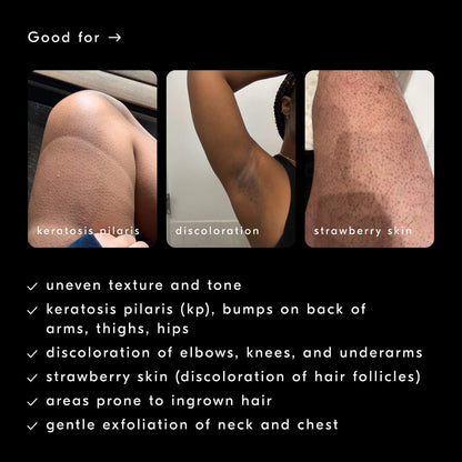 Smoothing Solution AHA Chemical Peel Body Exfoliator