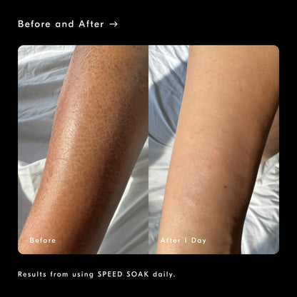 Speed Soak Fast-Absorbing + Hydrating Body Gel Moisturizer