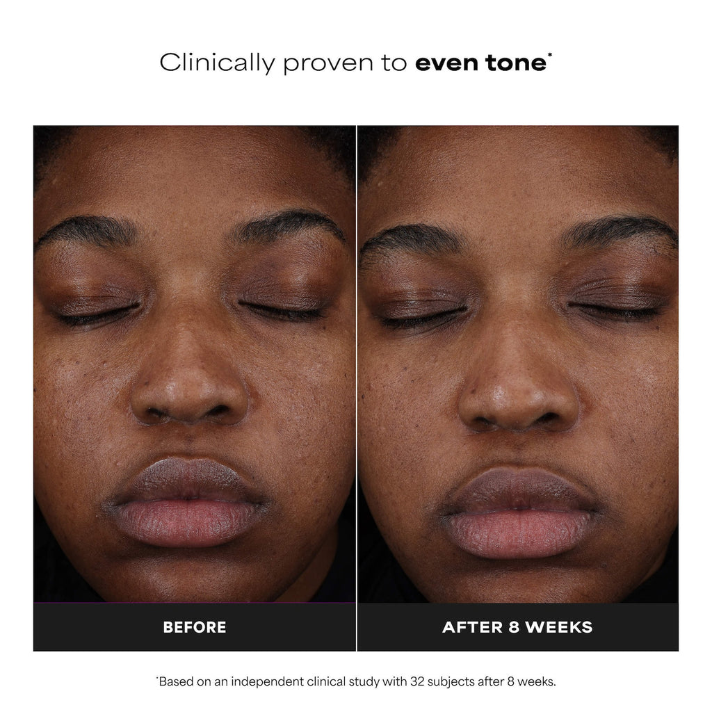 25% Vitamin C + Glutathione Clinical Serum for Brightening & Dark Spots