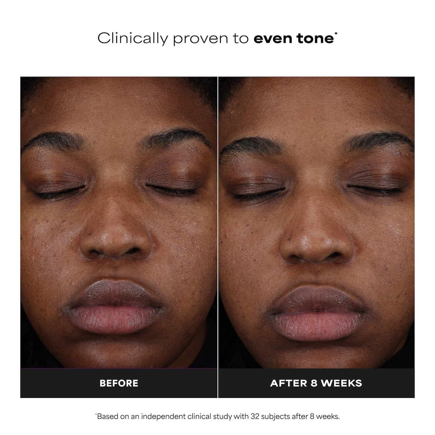 25% Vitamin C + Glutathione Clinical Serum for Brightening & Dark Spots
