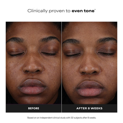 25% Vitamin C + Glutathione Clinical Serum for Brightening & Dark Spots