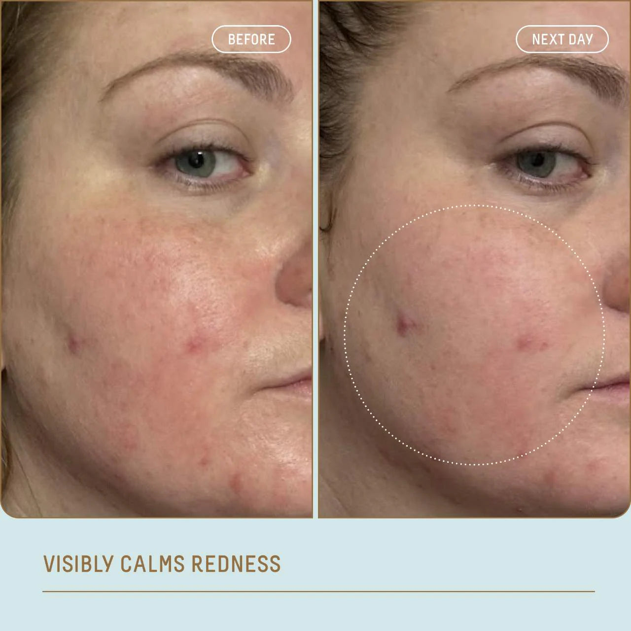Ectoin Overnight Rescue Deep Repair Night Moisturizer + Squalane