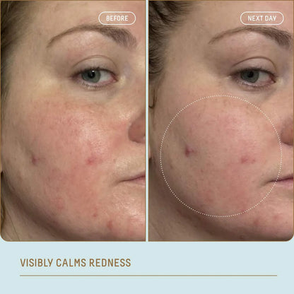 Ectoin Overnight Rescue Deep Repair Night Moisturizer + Squalane