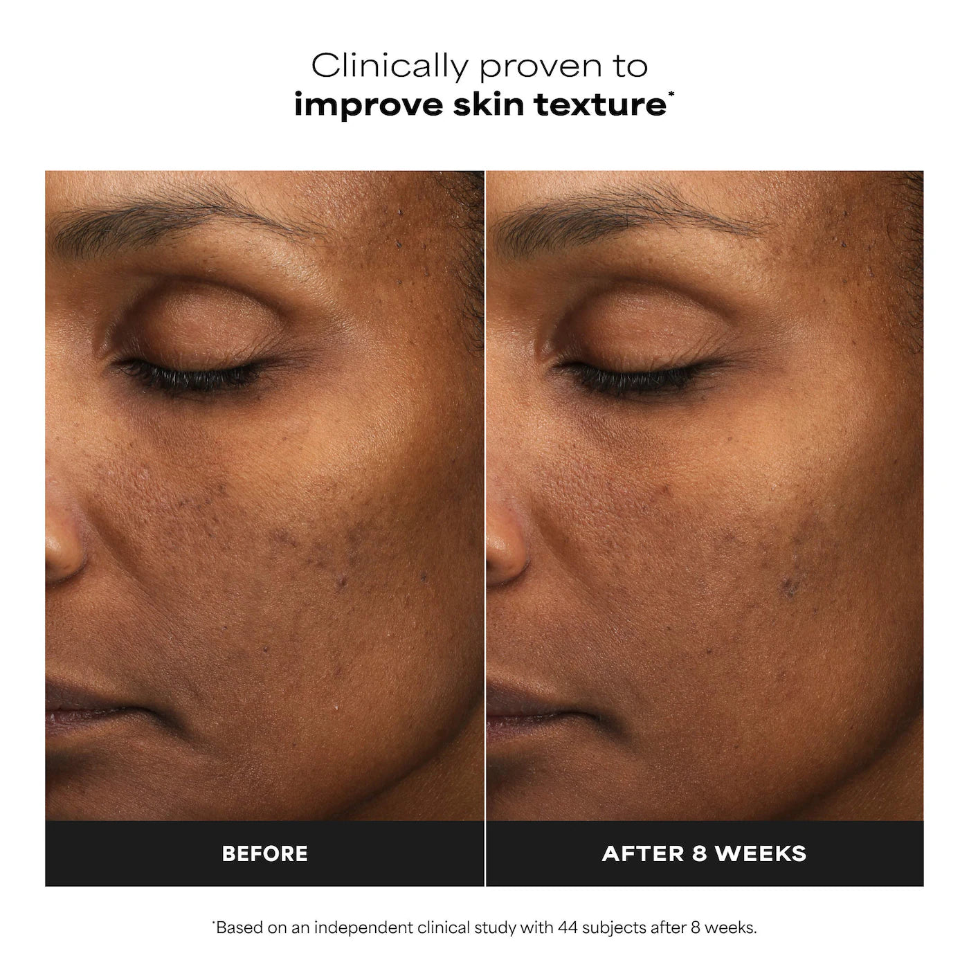 6% Mandelic Acid + 2% Lactic Acid AHA Liquid Exfoliant for Dark Spots, Textured Skin