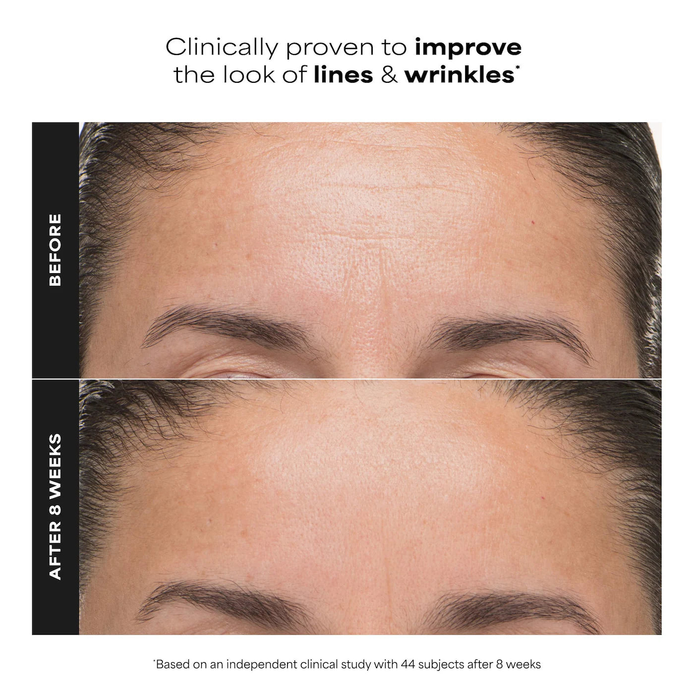 6% Mandelic Acid + 2% Lactic Acid AHA Liquid Exfoliant for Dark Spots, Textured Skin