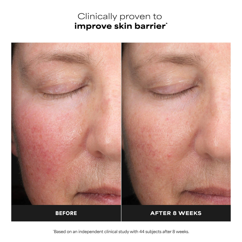 6% Mandelic Acid + 2% Lactic Acid AHA Liquid Exfoliant for Dark Spots, Textured Skin
