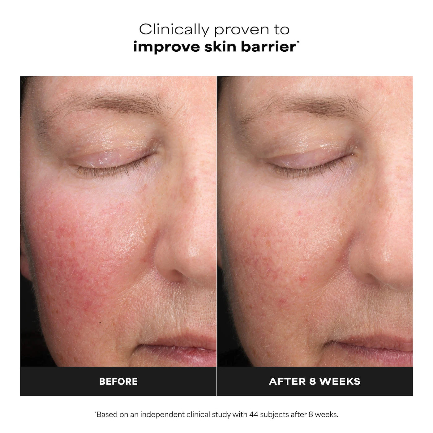 6% Mandelic Acid + 2% Lactic Acid AHA Liquid Exfoliant for Dark Spots, Textured Skin