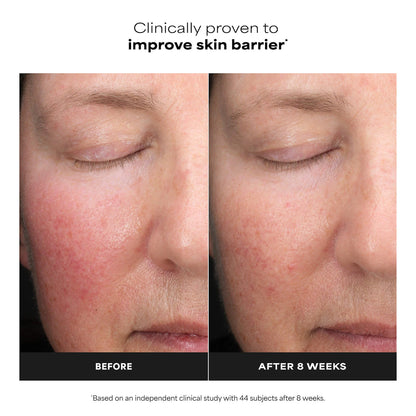 6% Mandelic Acid + 2% Lactic Acid AHA Liquid Exfoliant for Dark Spots, Textured Skin